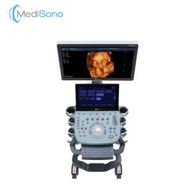 Máy siêu âm Doppler màu chuyên nghiệp - P25 EXPERT